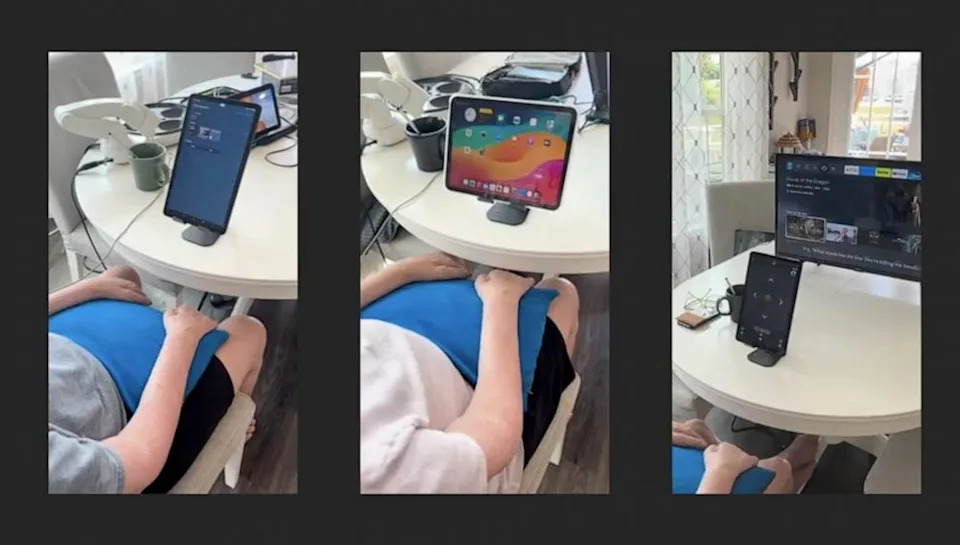 Synchron - PHOTO: A BCI is a sensor Implanted into the brain that translates brain signals into actions outside of the body. Jackson can watch TV shows, visit social media and send messages without the use of his hands or voice commands.