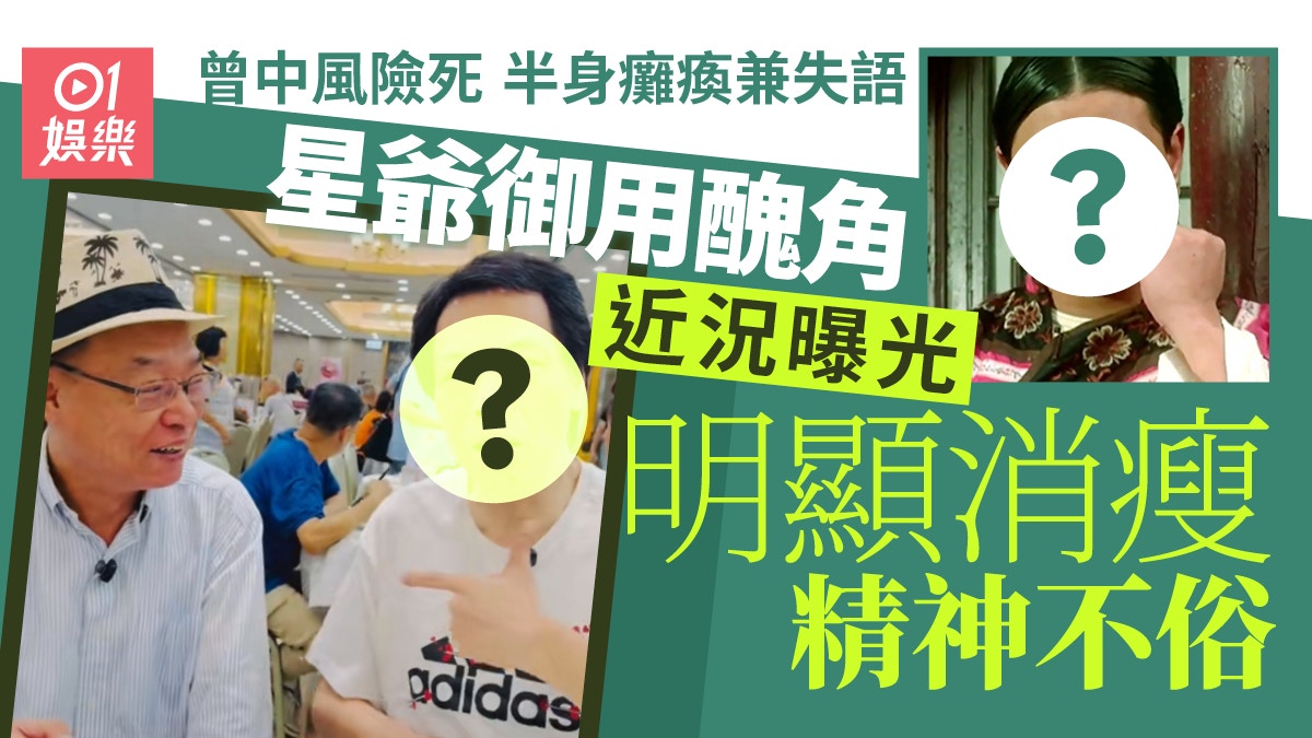 星爺御用醜角近況曝光明顯消瘦　曾中風險死半身癱瘓兼失語