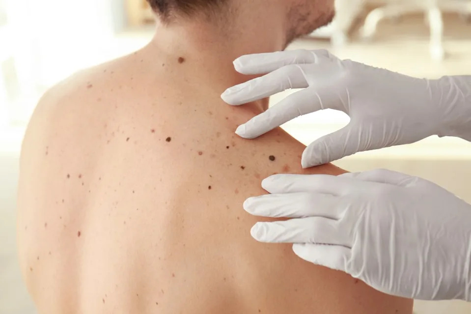 It’s important to get regular skin checkups to make sure you don’t have concerning spots. Africa Studio – stock.adobe.com