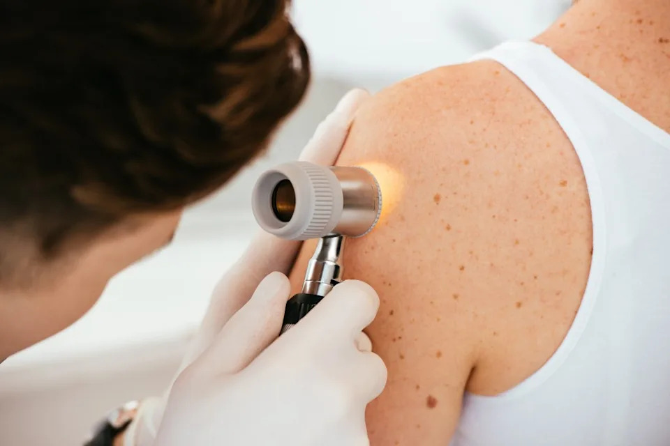 Dermatologists recommend people conduct regular self exams to check for signs of skin cancer. LIGHTFIELD STUDIOS – stock.adobe.com