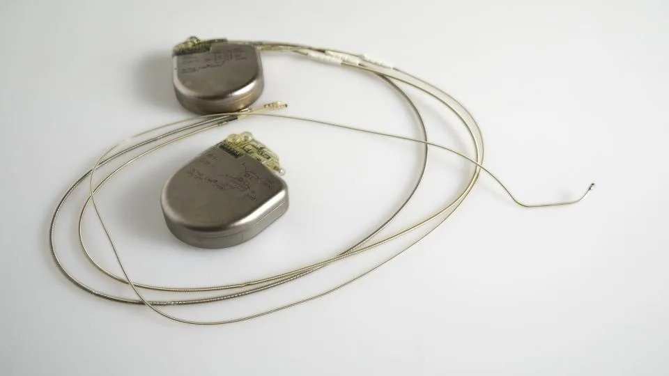 An implantable cardioverter-defibrillator, or ICD, with leads and a modem for home telemonitoring. The device regularly sends data to the hospital. - ArjanL/iStockphoto/Getty Images