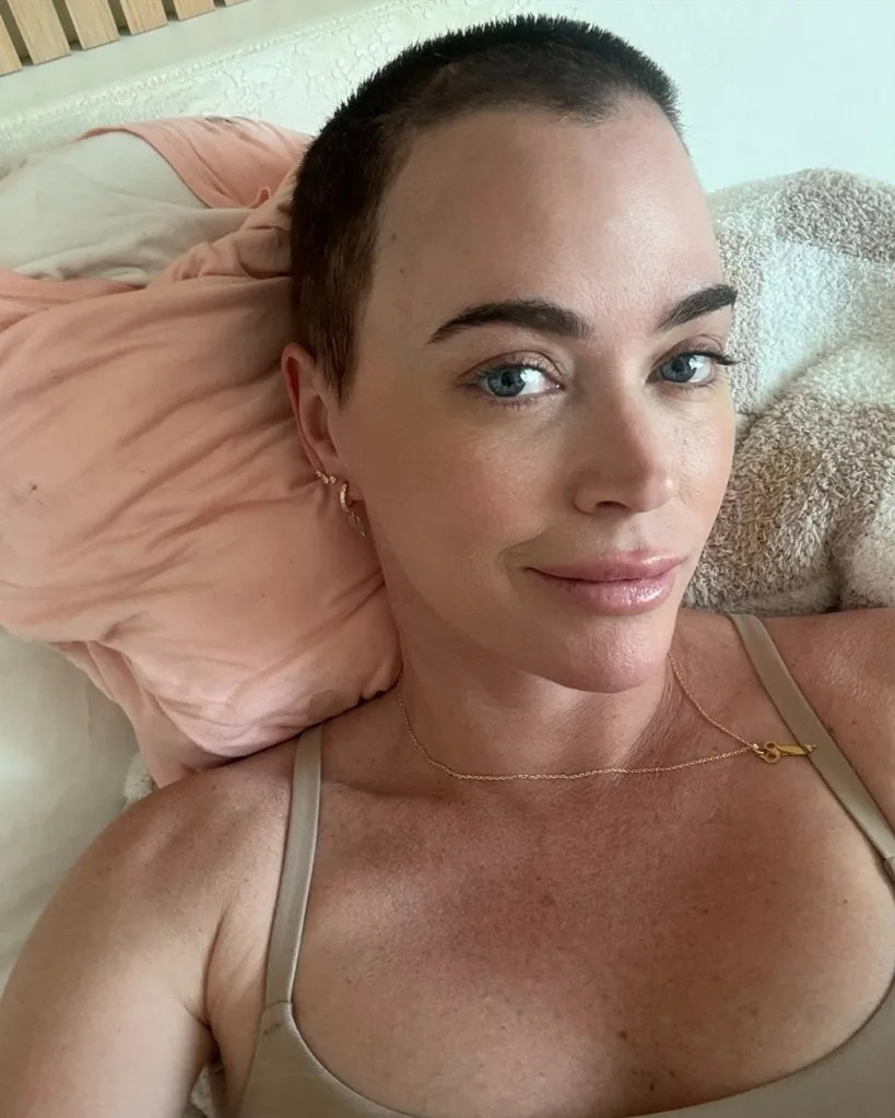 “Real Housewives of Beverly Hills” alum Teddi Mellencamp was diagnosed with melanoma in 2022. teddimellencamp/Instagram