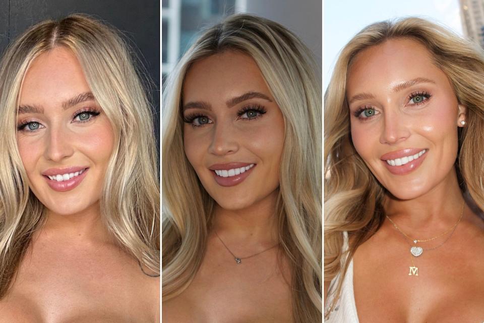 Mackenzie Nichols con sus dientes naturales, las carillas temporales y la versión final. (Courtesy of Mackenzie Nichols)