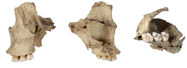 Three images of cannibalized human maxilla 