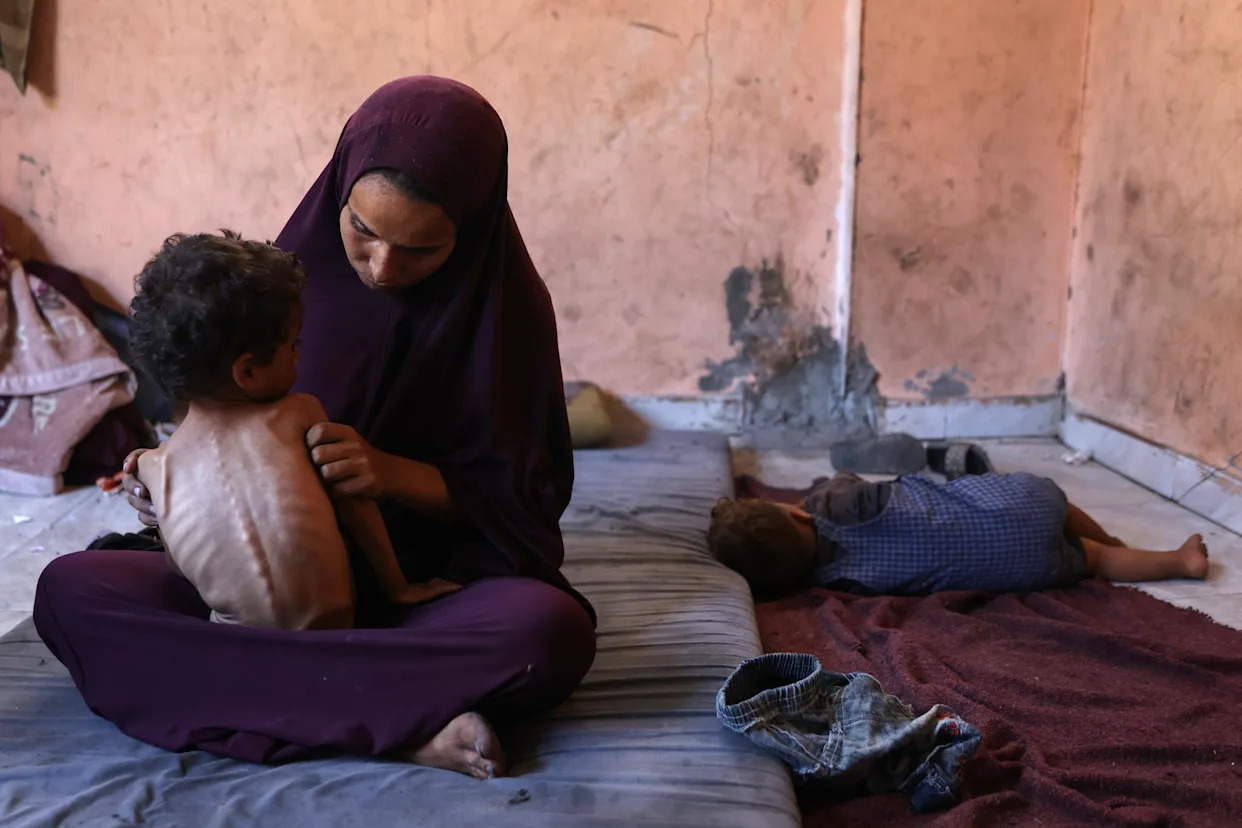 Amid Gaza famine, Palestinian girl struggles to survive