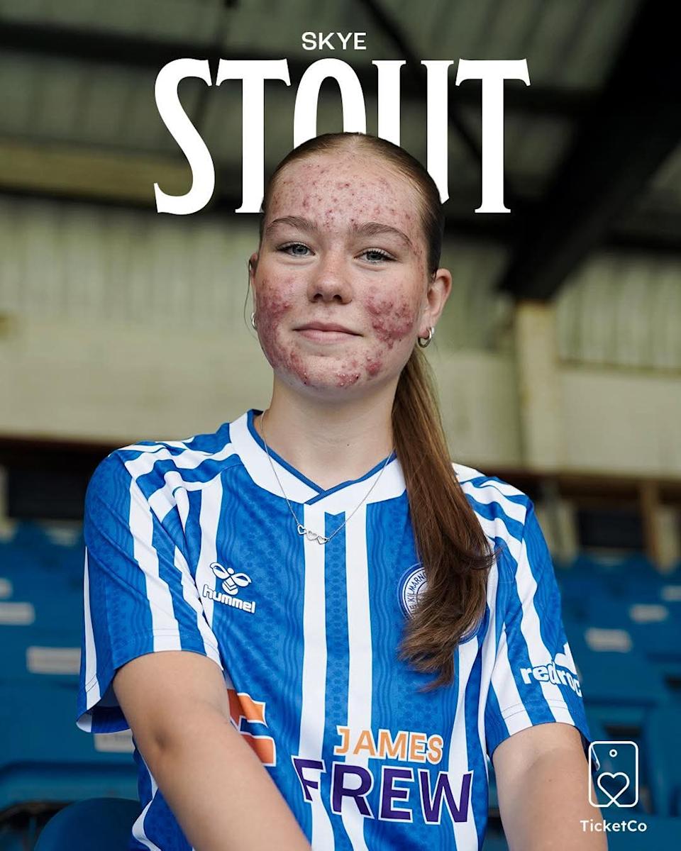 Skye Stout: La joven futbolista que sufrió terribles burlas pero cerró bocas
