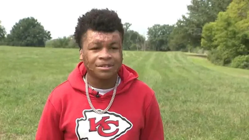 Kansas City teen shares story of survival after nearly dying from abuse