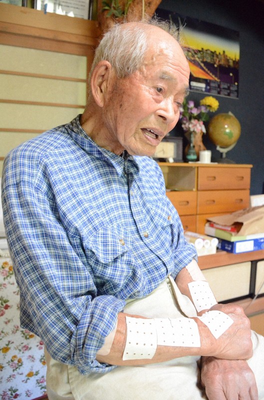 残されたのは“80年続く右腕の痛み”　ウラン採掘に動員された少年