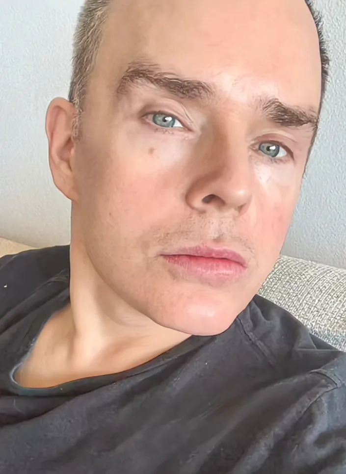 A person with short hair and wearing a shirt is looking directly at the camera, with a neutral expression