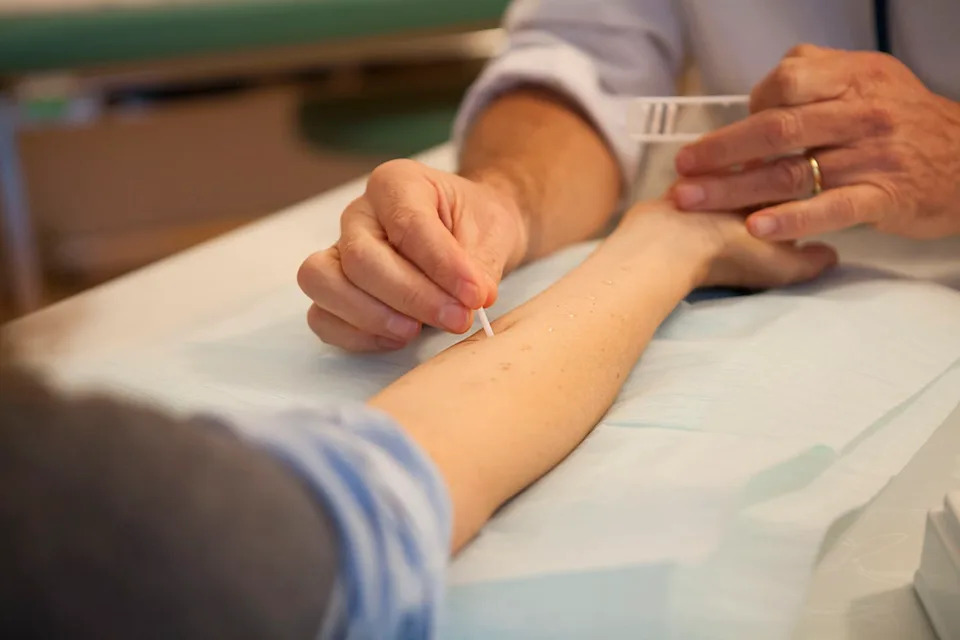 An arm stretched out on an examining table gets pricked with a white needle by the hands of a clinician administering an allergy test.