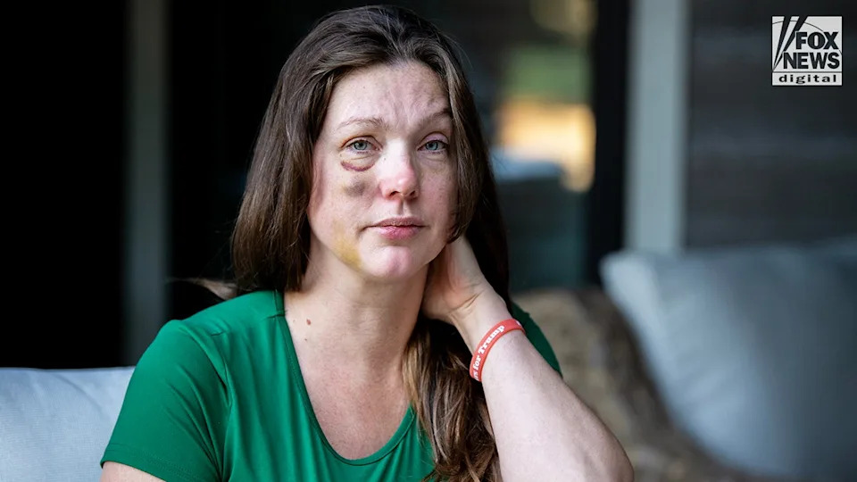 Cincinnati viral beating victim says violent mob started attacking 'like a pack of wolves'
