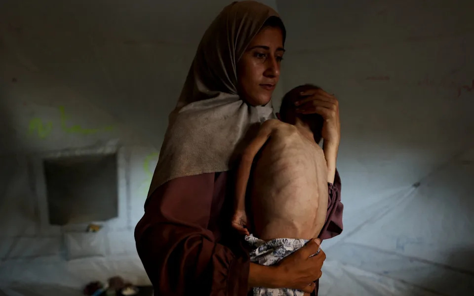 A photo of Mohammed Zakaria al-Mutawaq, the 18-month-old boy child pictured here, caused international outrage last month