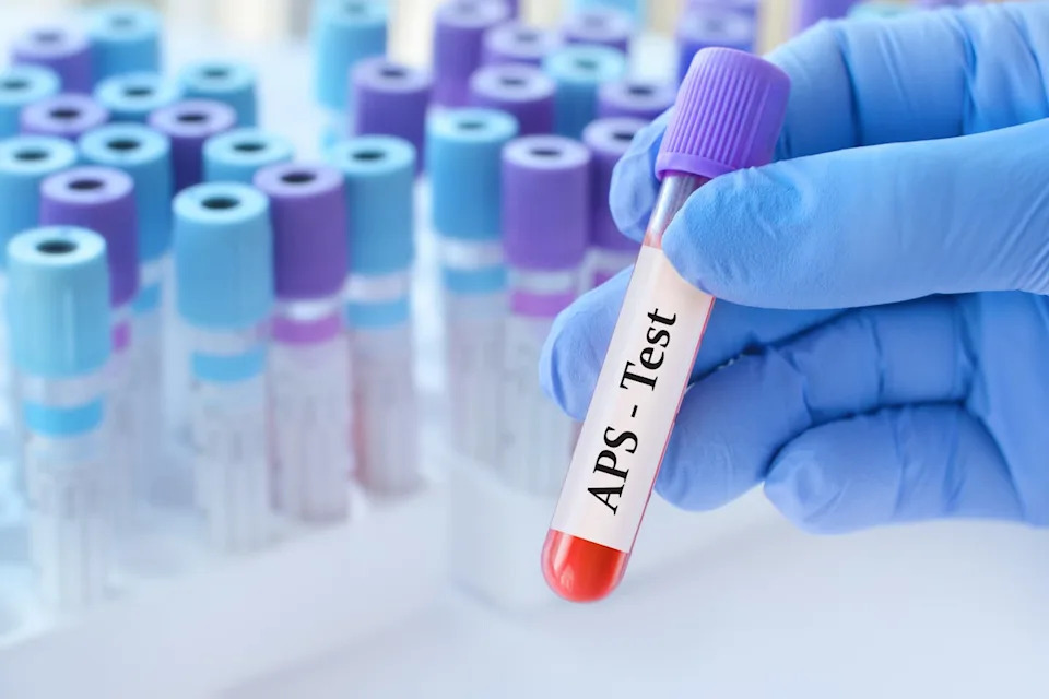 Gloved hand holding a vial of blood used for a blood test, with a collection of vials in the background.