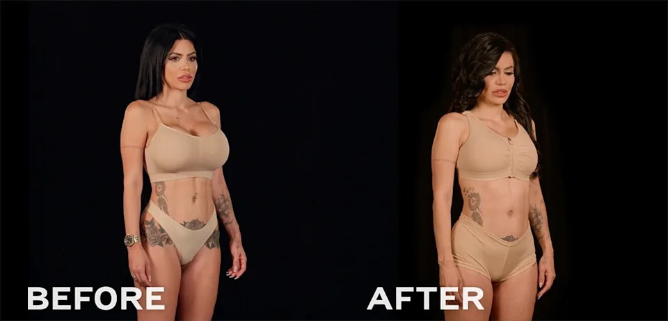 Larissa Santos Lima Reveals New Look After Removing Breast Implants