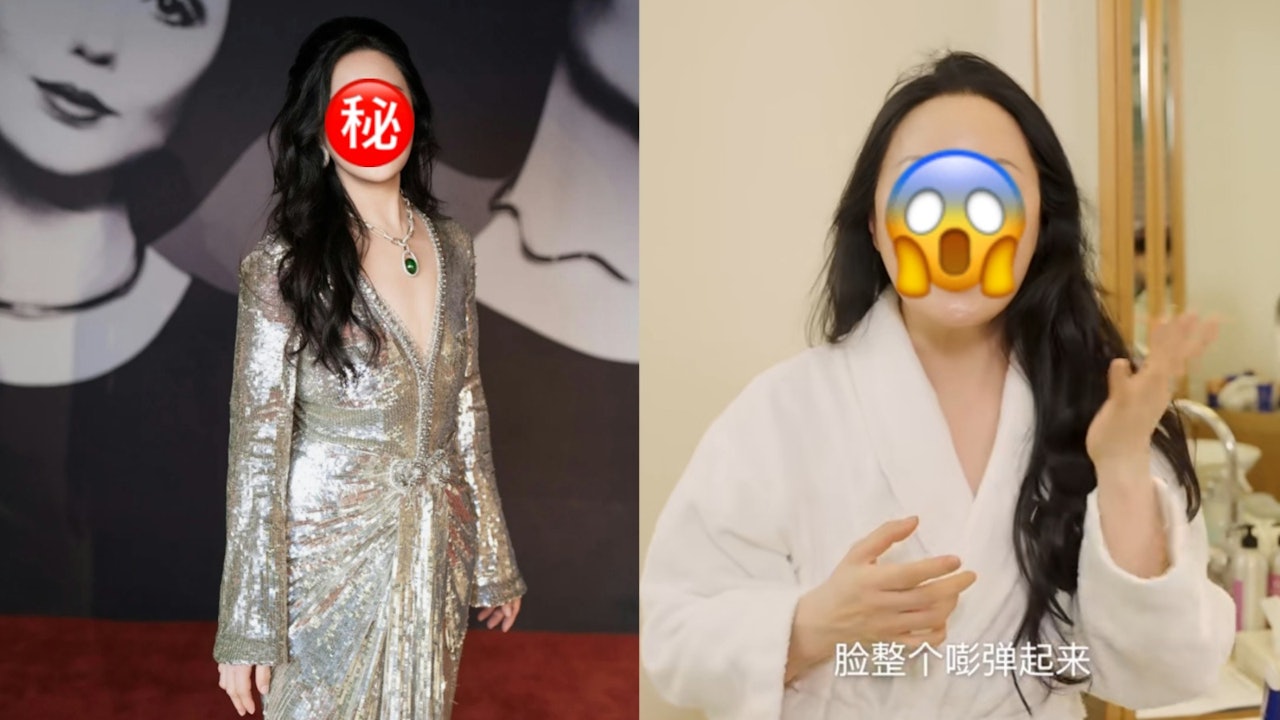 初代拜金名媛飛德國享受貴族級護膚療程　皮膚年齡只有40歲超驚人