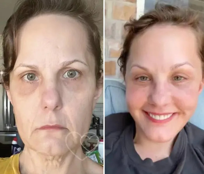 This Man's Mexico Facelift Has Everyone's Jaws On The Floor, And Over 6 Million People Can't Even Process What They're Seeing