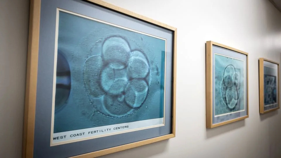 Images of cells dividing are seen at West Coast Fertility Centers in February 2024 in Fountain Valley, California. - Jay L Clendenin/The Washington Post/Getty Images