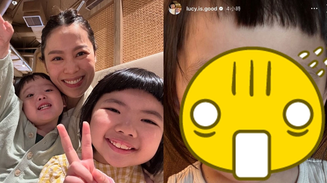 李元元胞妹Sucy嚴重紅腫令人擔心：佢會對自己嘅眼淚敏感