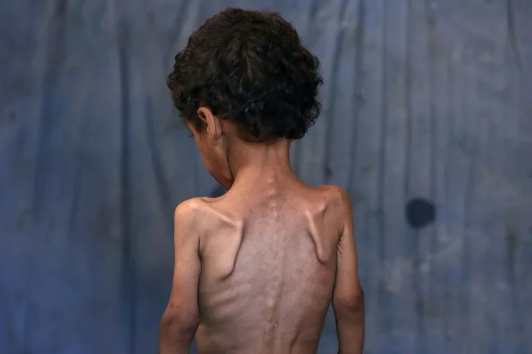 Aid and human rights groups warn 'mass starvation' is spreading in Gaza (Omar AL-QATTAA)
