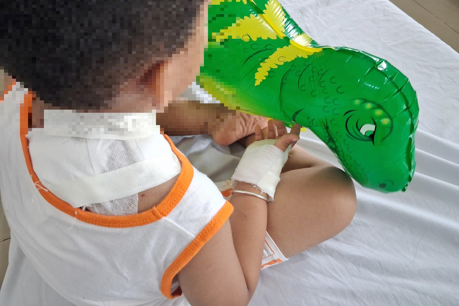 Bé trai 4 tuổi bị chó becgie của nhà cắn vào cổ và lưng