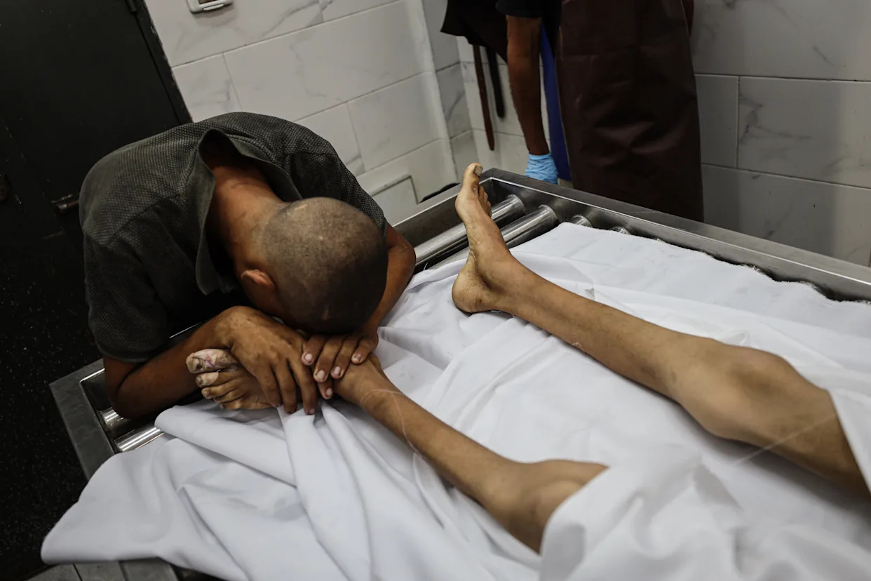 Palestinian boy, 17, dies of Israel-induced starvation in Gaza