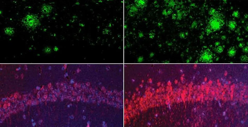 Top row: In a mouse model of Alzheimer’s disease, lithium deficiency (right) dramatically increased amyloid beta deposits in the brain compared with mice that had normal physiological levels of lithium (left) Bottom row: The same was true for the Alzheimer’s neurofibrillary tangle protein tau. (Yankner Lab)