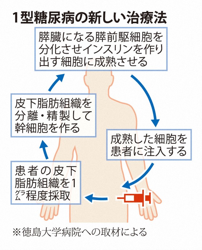 1型糖尿病の新しい治療法