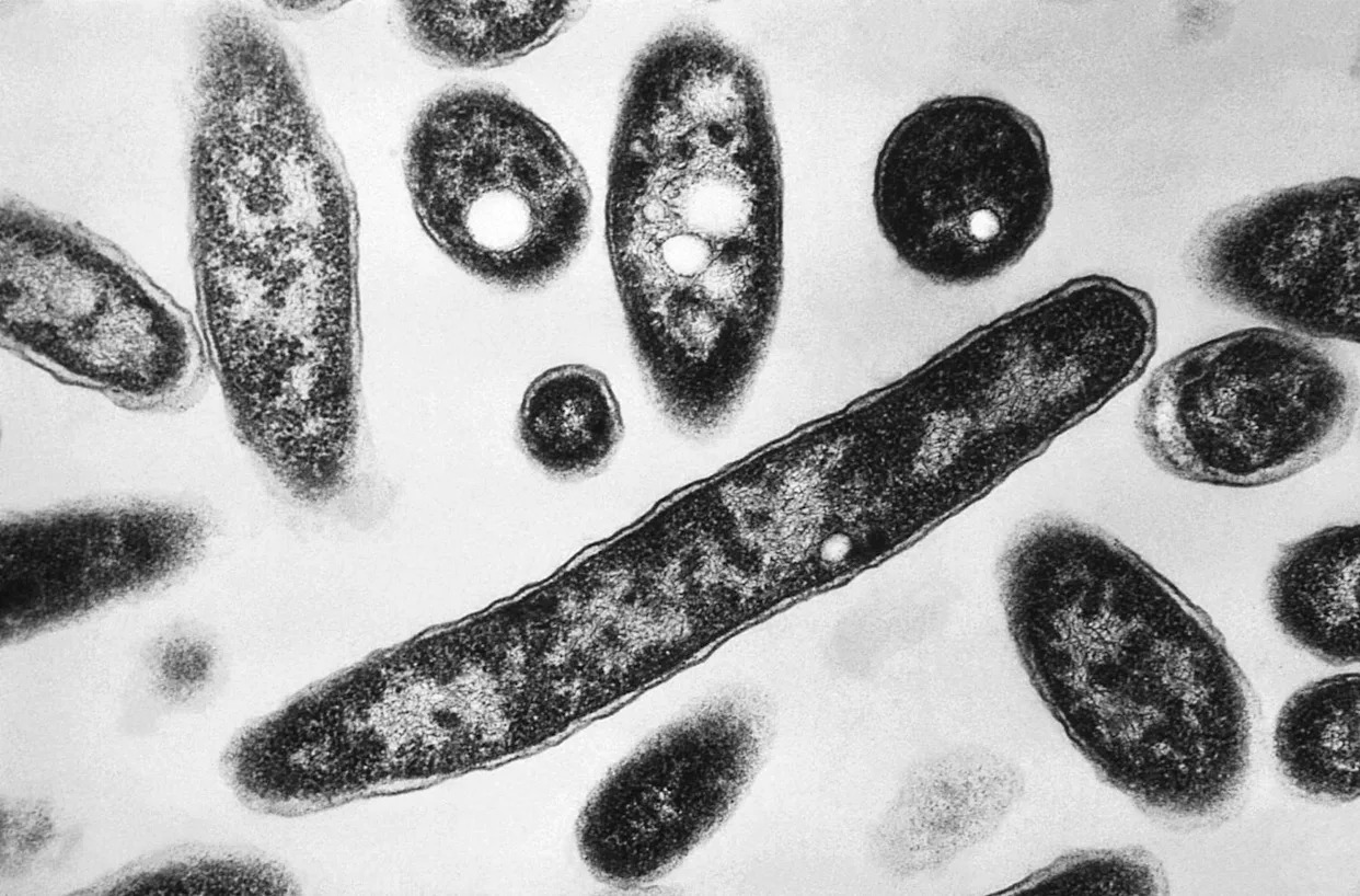 1 dead, 22 sick from Legionnaires' cluster in Harlem, health officials say