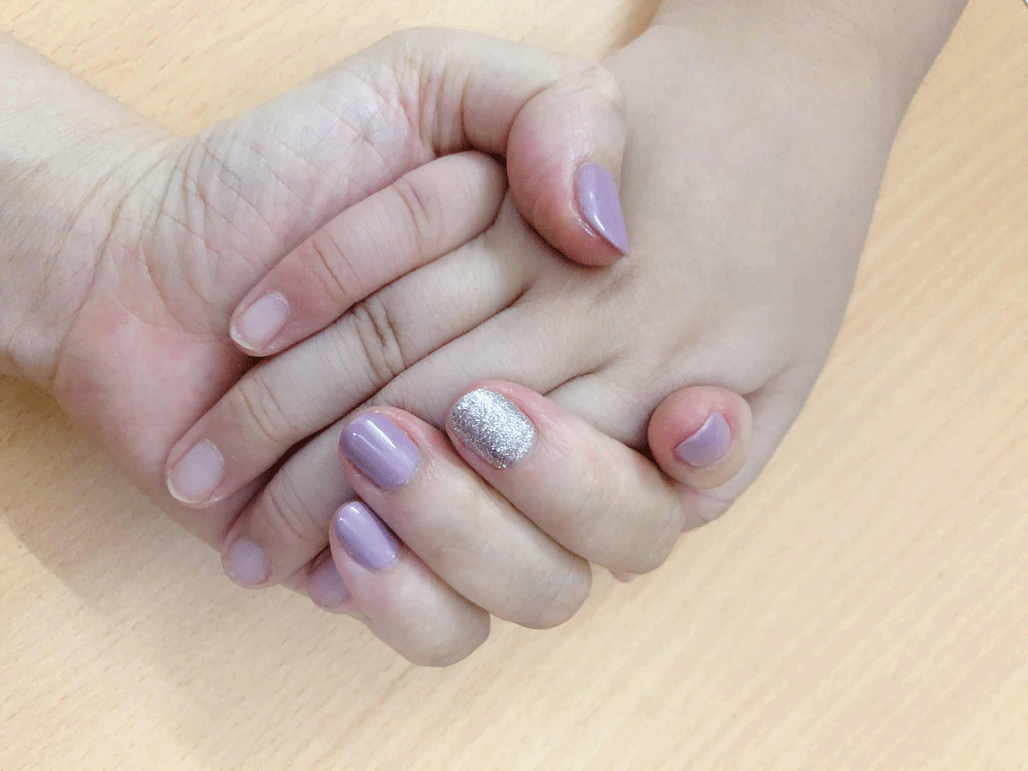 5 dấu hiệu trên tay báo hiệu thận suy, ăn '3 đen' giúp phục hồi