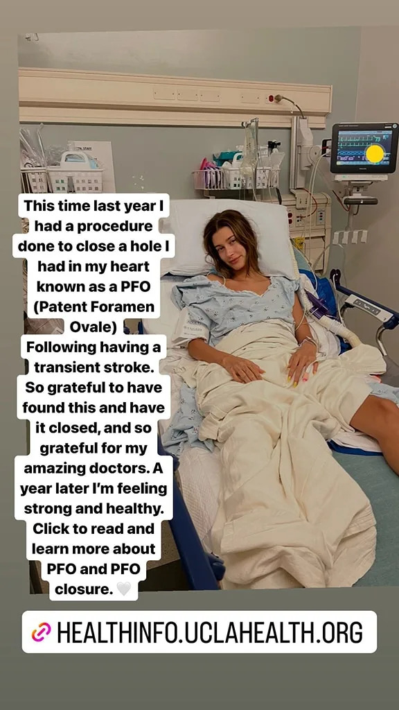 <p>Hailey Bieber's Blood Clot</p>