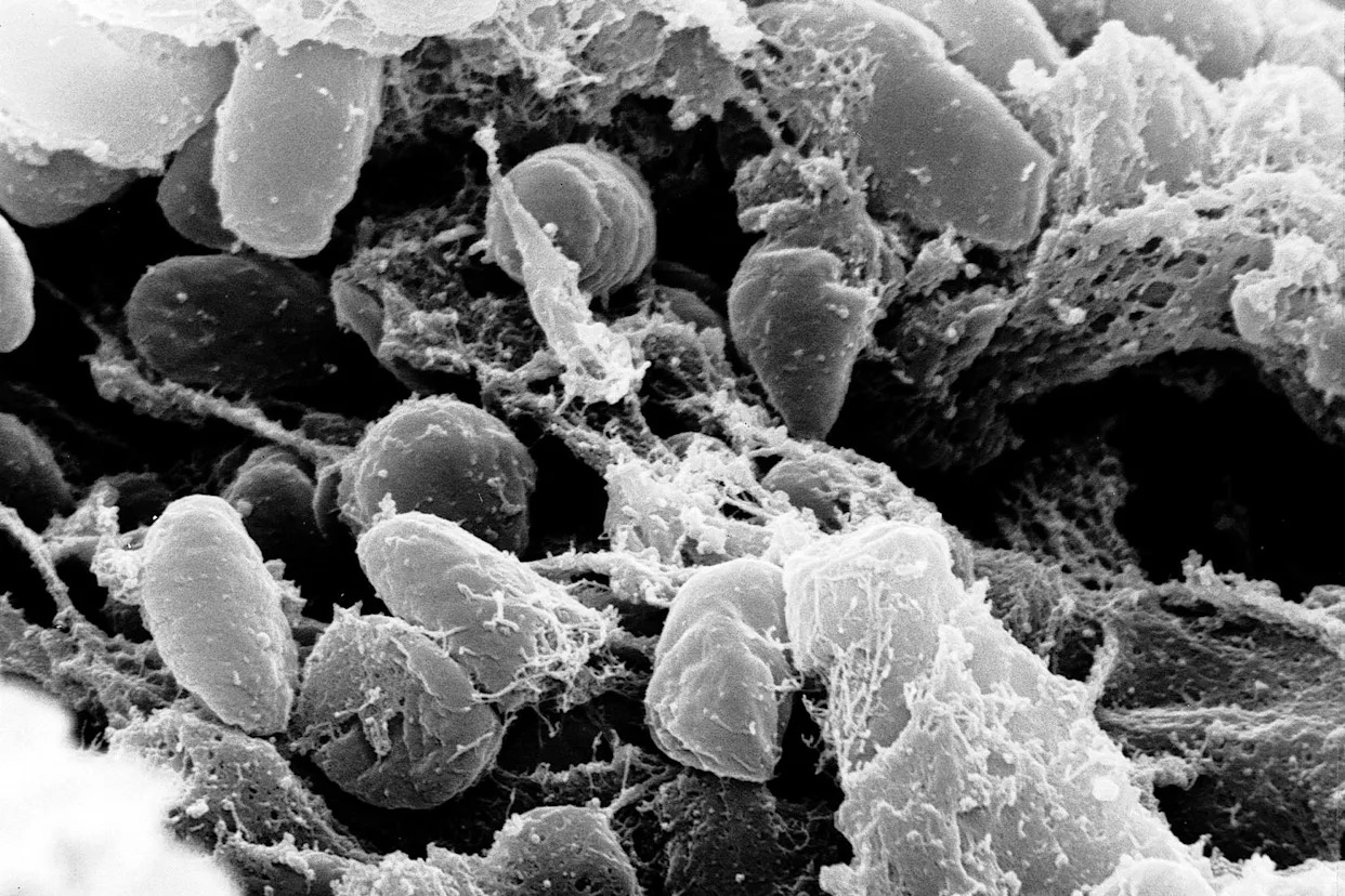California resident catches the plague, likely from infected flea at Lake Tahoe, officials say
