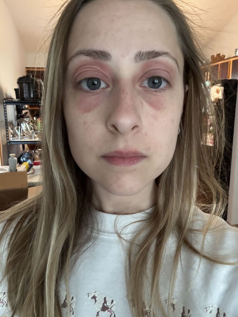 Sara Smith came down with severe health issues after moving into a house riddled with mold. Kennedy News/@applfrittr11