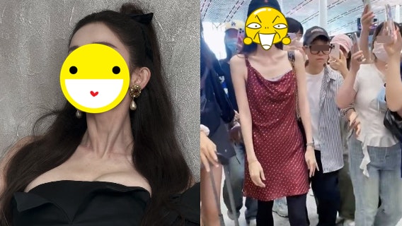 33歲女偶像過瘦現「排骨胸」　紙片人身形驚嚇人健康狀況令人擔憂