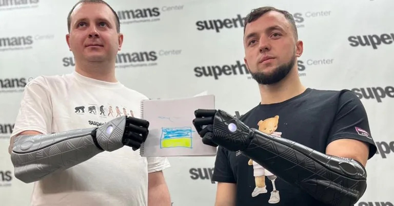 bionic arms
