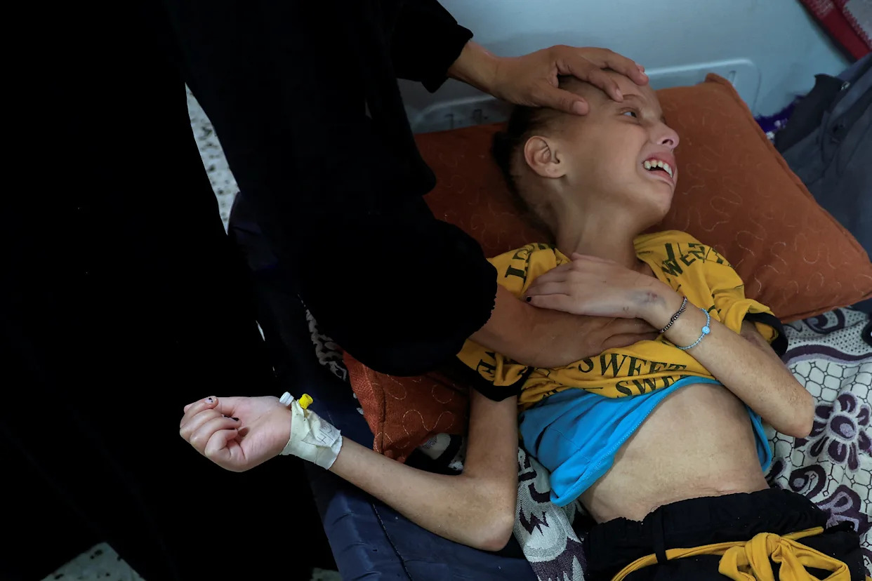 Tens of thousands of Palestinian children starving in Gaza tent camps