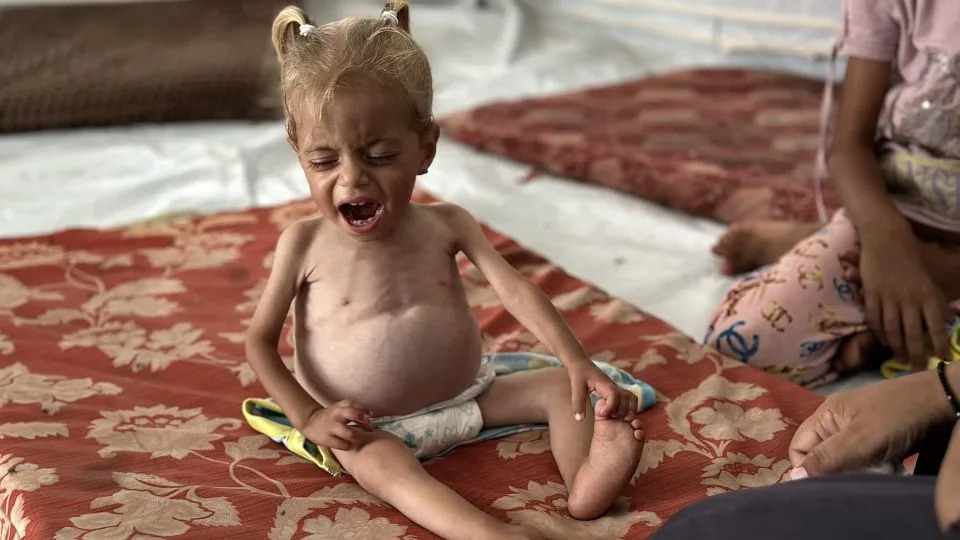 Gaza is starving and outrage is spreading. Will Netanyahu listen?