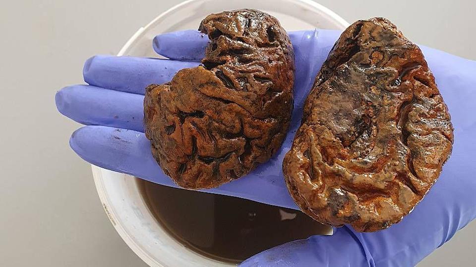 La científica que colecciona cerebros antiguos y busca descifrar por qué pueden perdurar hasta miles de años