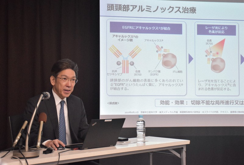 光免疫療法とがん治療薬の併用　最終治験を開始　400人超対象　