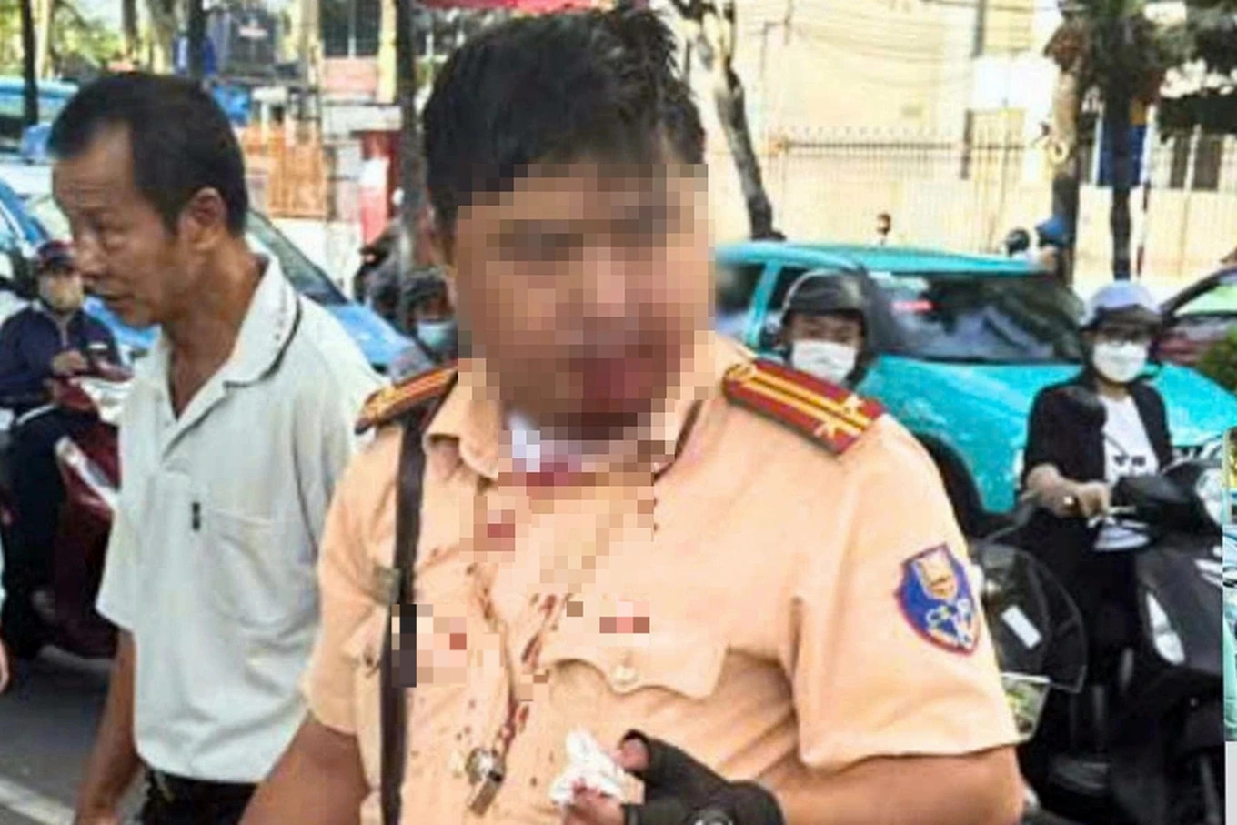 Thanh niên người Nga đấm vào mặt Trung tá CSGT ở Nha Trang bị tạm giữ hình sự