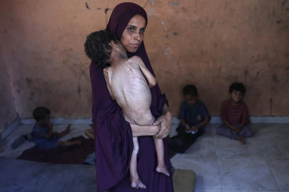A Palestinian mother carries her malnourished 2-year-old son.