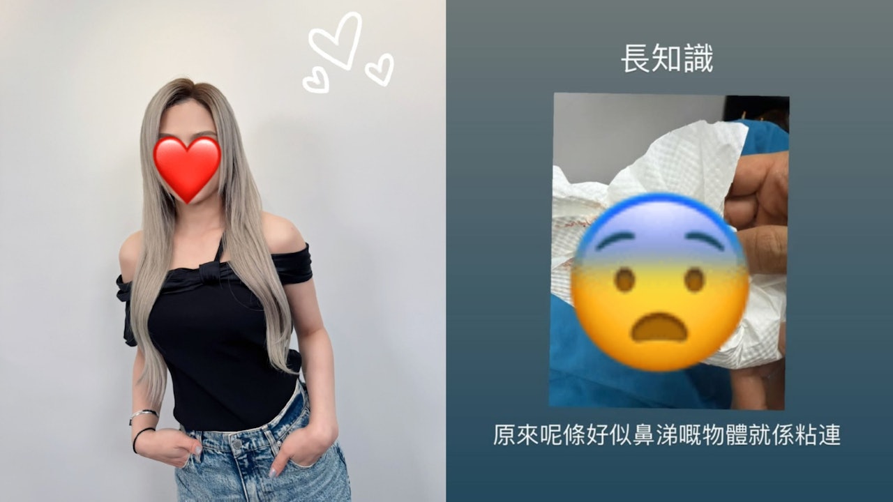 樂壇天后接受放血拔罐治療　曬染血紙巾令人擔憂：慶祝我仲有生命