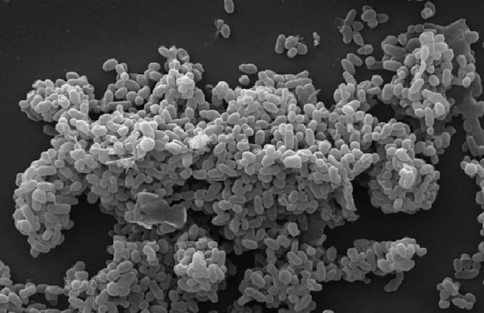 Out-of-balance bacteria is linked to multiple sclerosis − the ratio can predict severity of disease