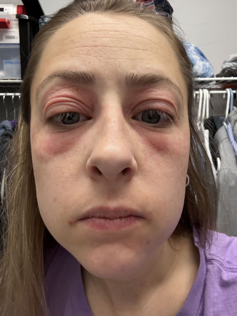 After feeling “ugly” in pictures, Smith decided to ask social media for help. Kennedy News/@applfrittr11
