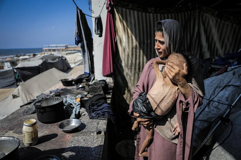 Muhammad Zakariya Ayyoub al-Matouq, a 1.5-year-old child in Gaza City, Gaza