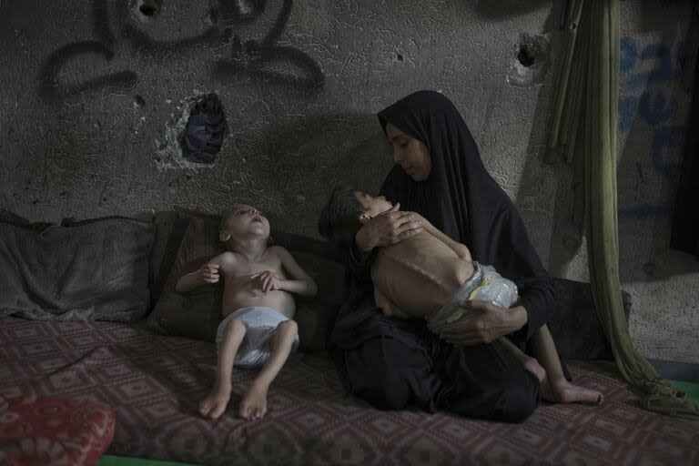 Una madre cuida a sus dos hijos que tienen un avanazado estado de malnutrición