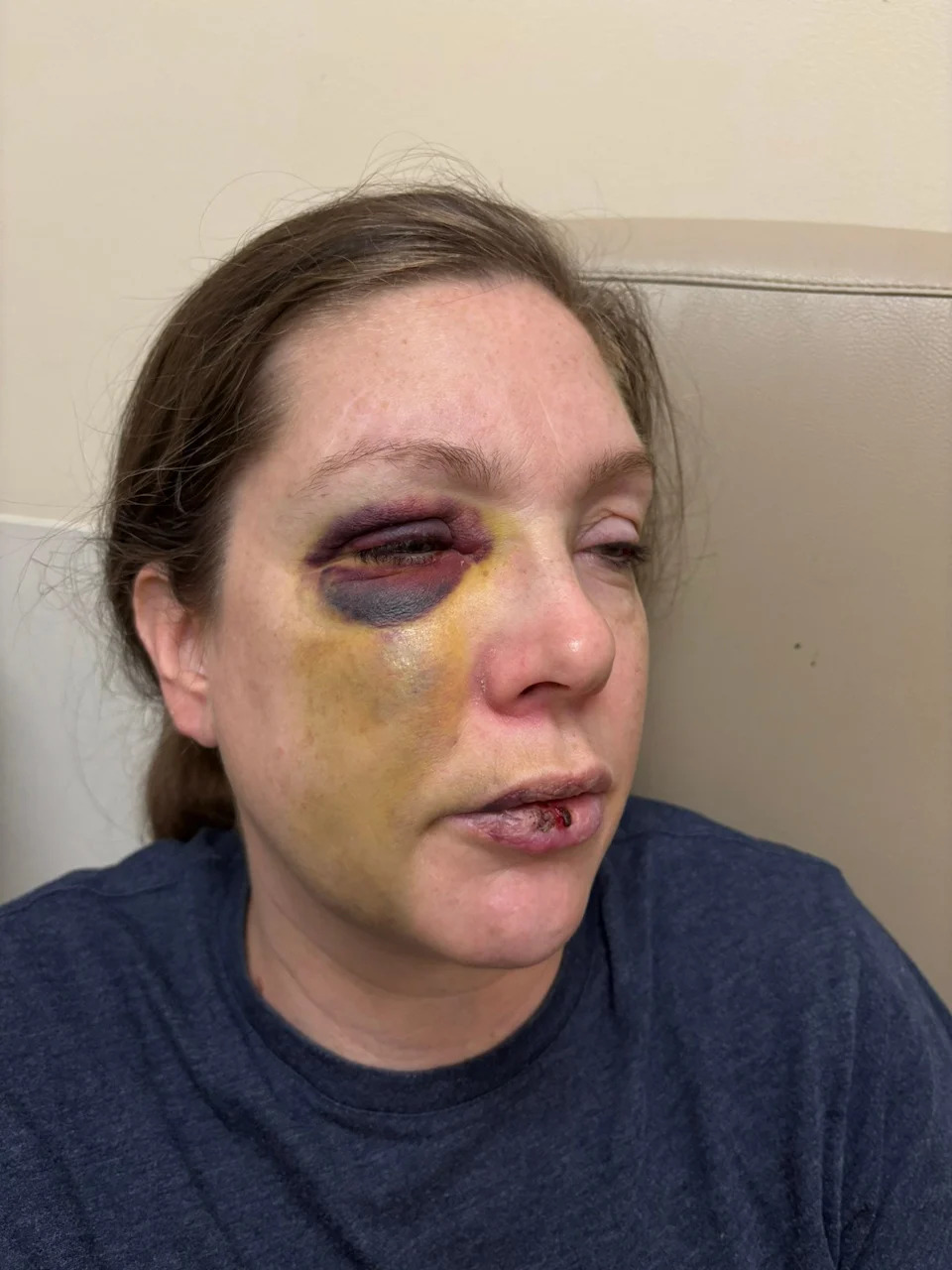 Woman knocked unconscious in viral Downtown fight says man arrested in Georgia struck her