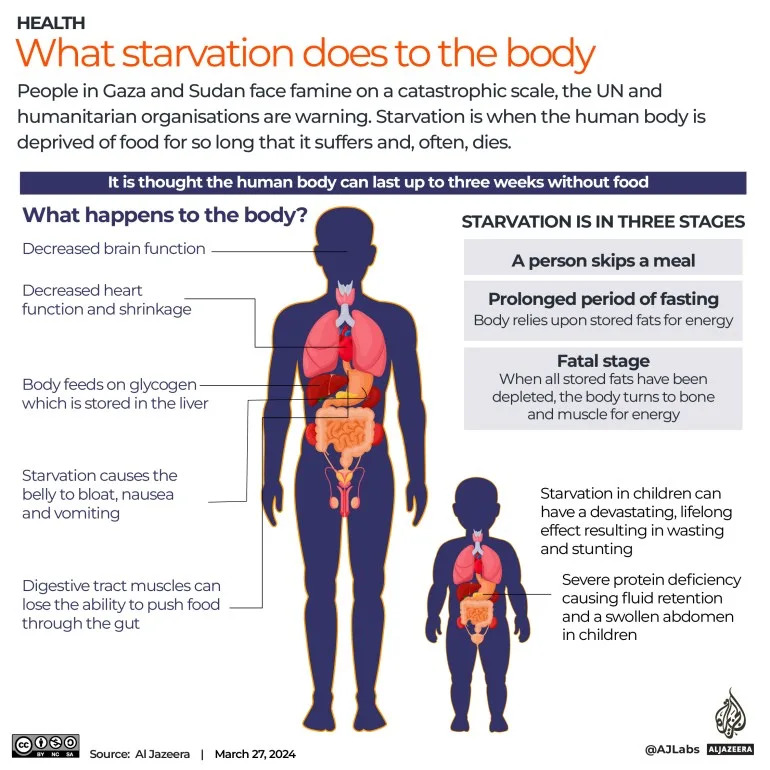 What ‘starvation’ really means, for the human body and for Gaza