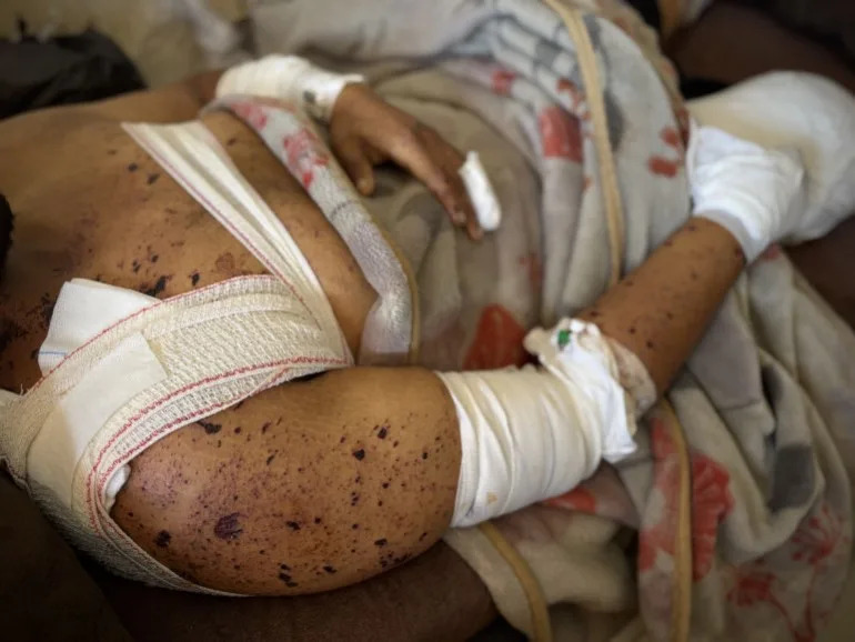 Israel pushes further into Gaza City, killing and displacing Palestinians