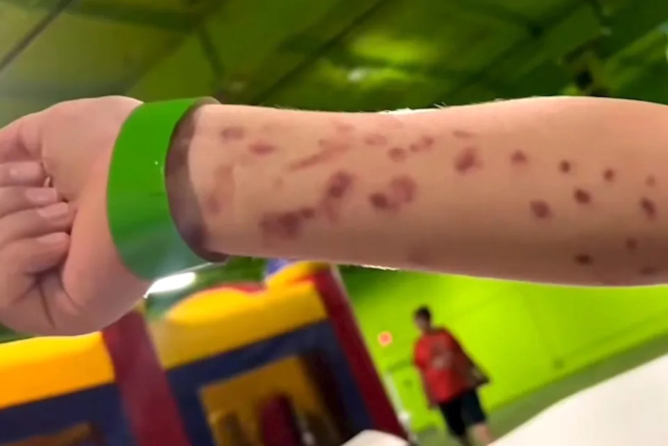 octopus marks (BritneyTaryn via TikTok)