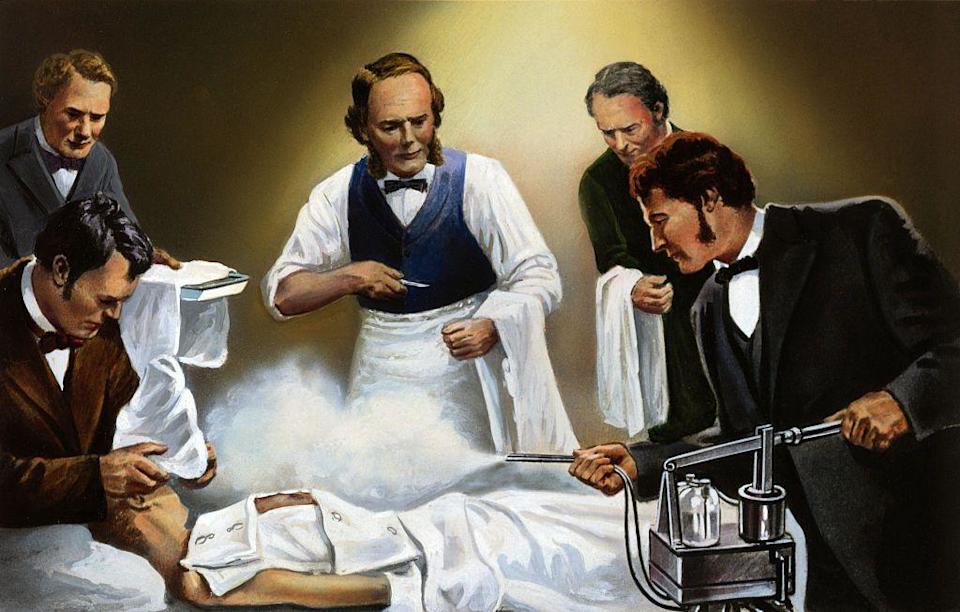 Joseph Lister dirigiendo el uso de ácido carbólico en aerosol en una de sus primeras intervenciones quirúrgicas antisépticas, circa 1865.